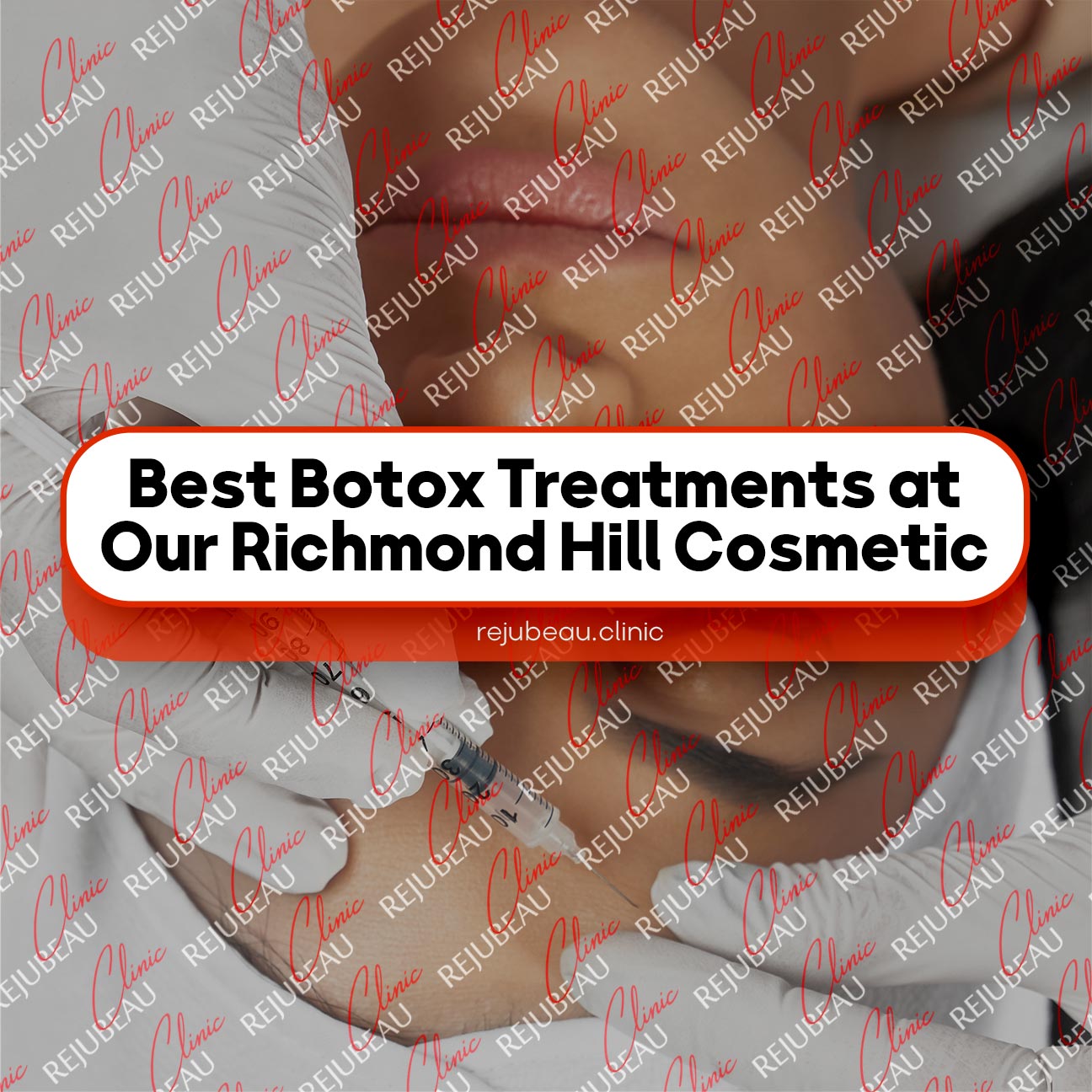 Best-Botox-Treatments-at-Our-Richmond-Hill-Cosmetic-Clinic