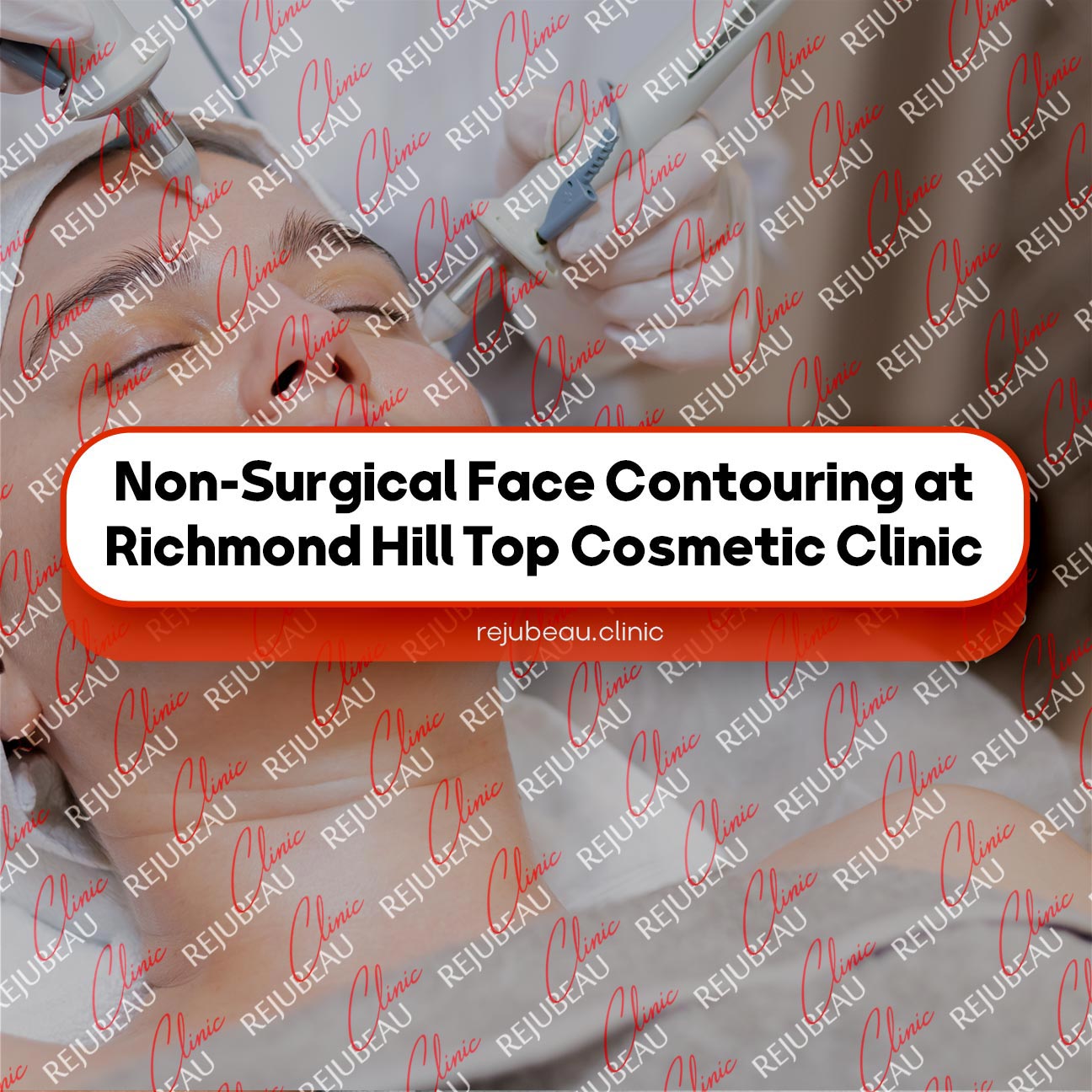 Non-Surgical-Face-Contouring-at-Richmond-Hill-Top-Cosmetic-Clinic