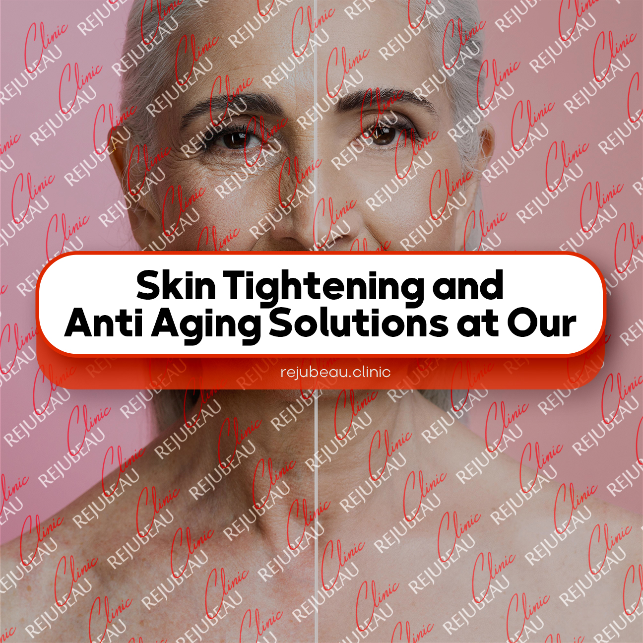 Skin-Tightening-and-Anti-Aging-Solutions-at-Our-Richmond-Hill-Clinic