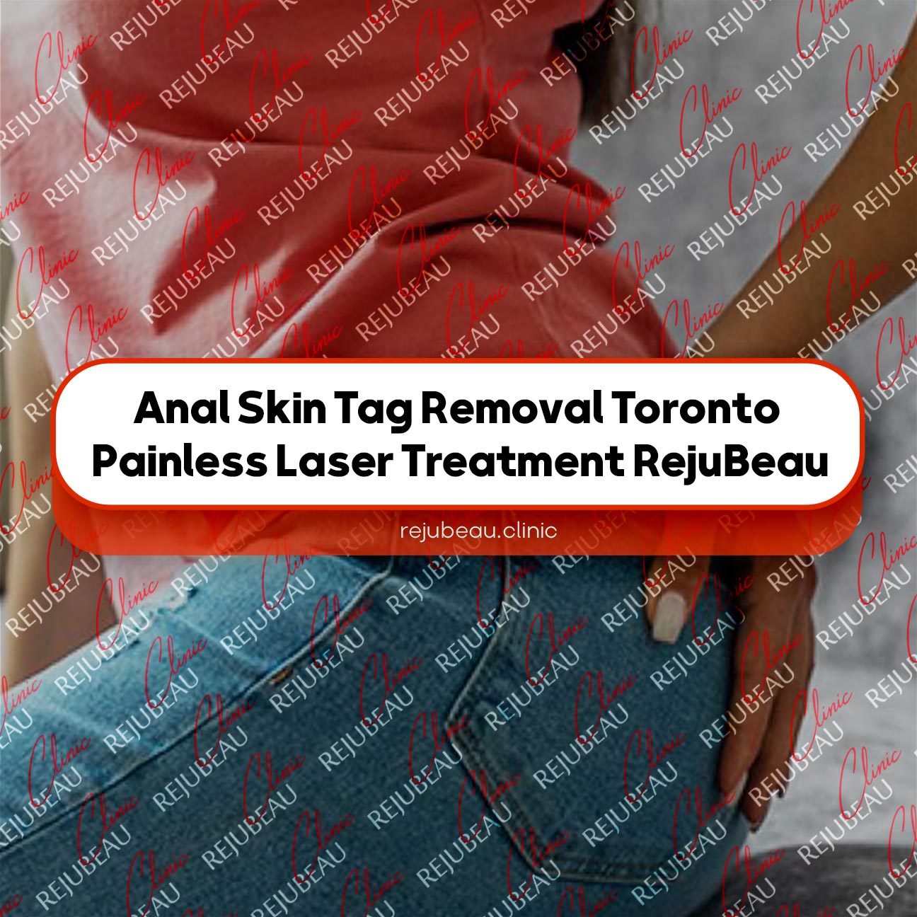 Anal-Skin-Tag-Removal-Toronto-Painless-Laser-Treatment-RejuBeau