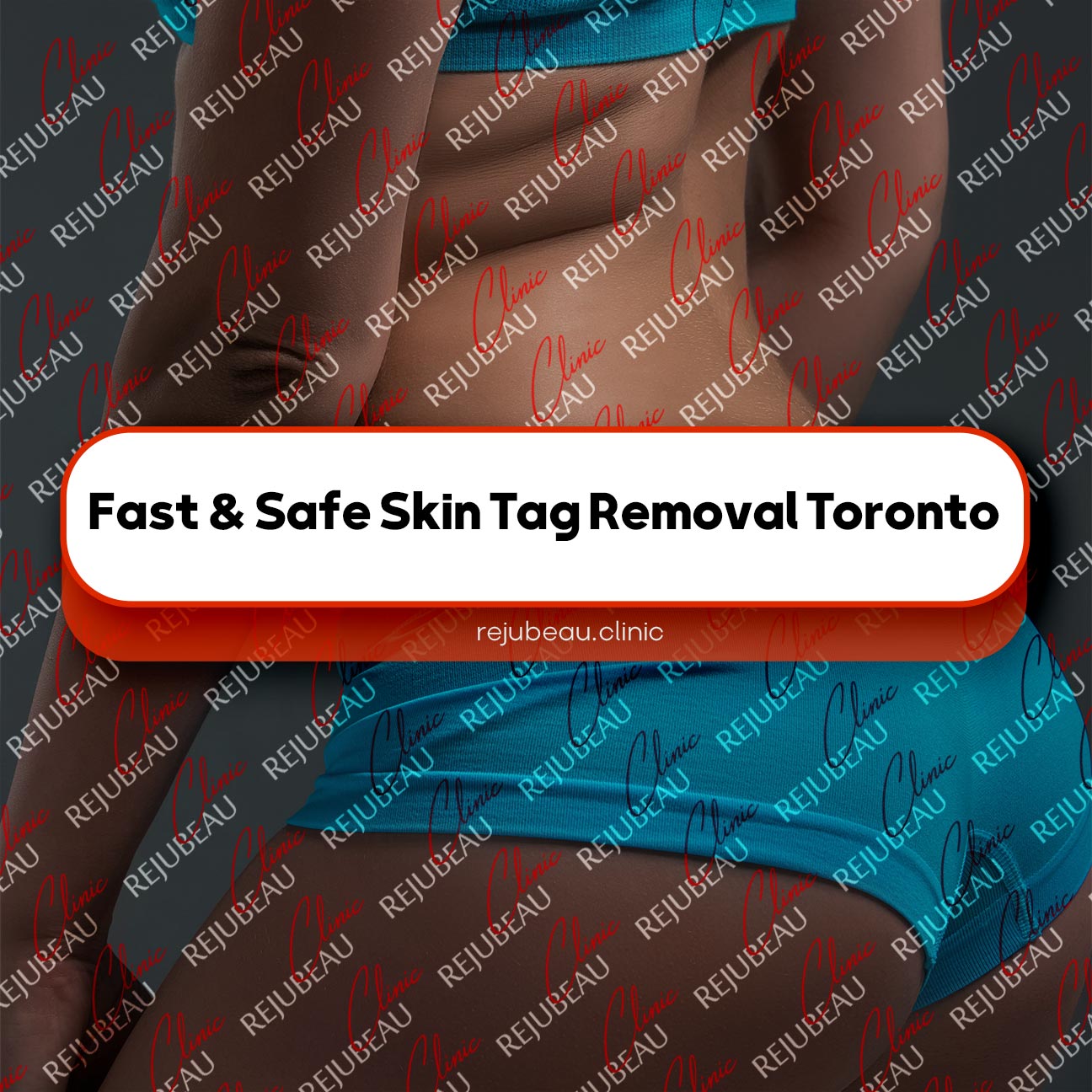 Fast-&-Safe-Skin-Tag-Removal-Toronto
