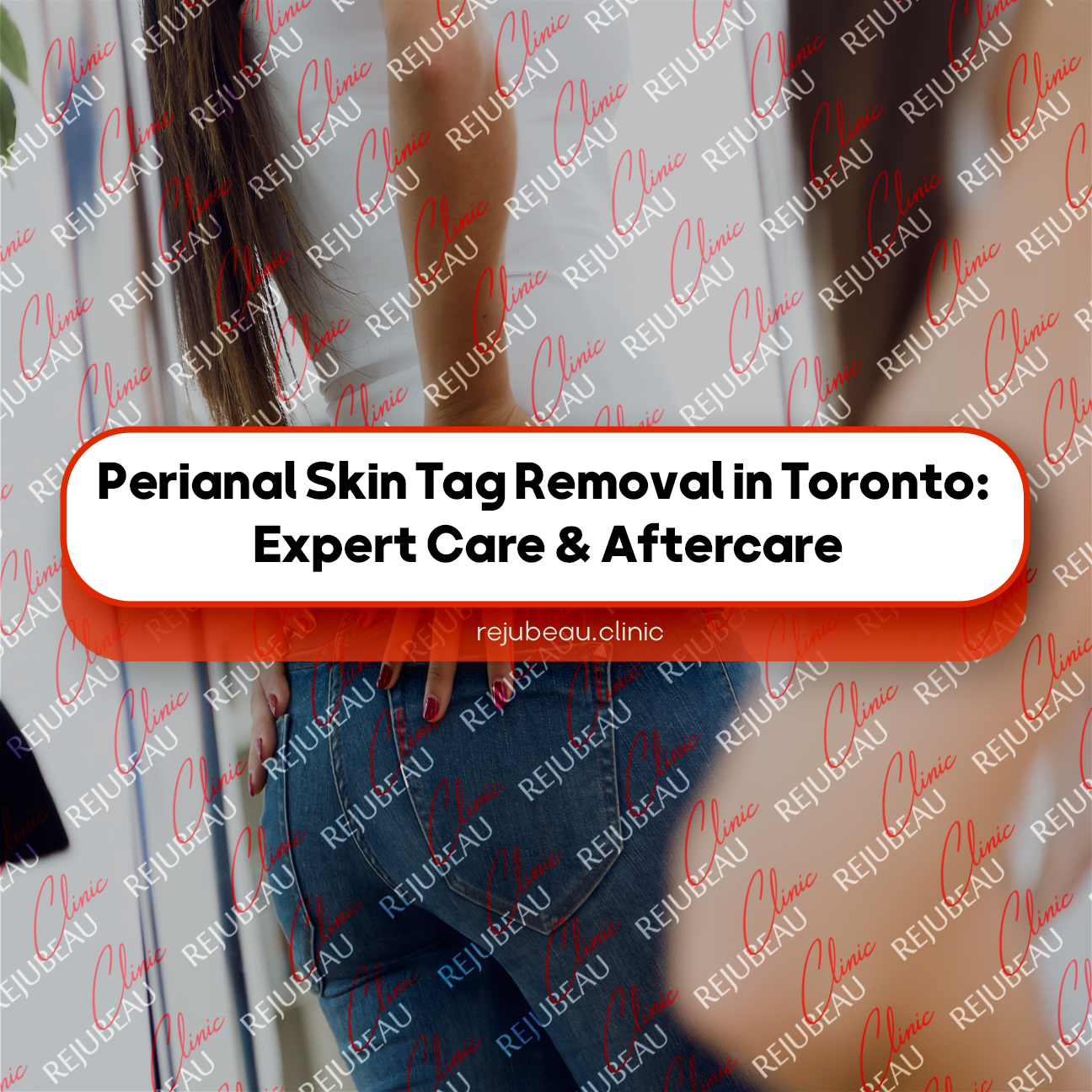 Perianal-Skin-Tag-Removal-in-Toronto-Expert-Care-&-Aftercare