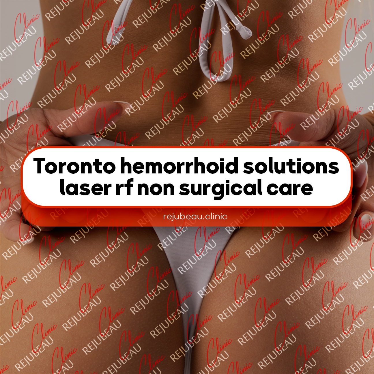 Toronto-hemorrhoid-solutions-laser-rf-non-surgical-care